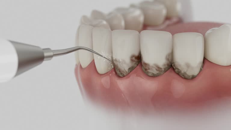 Reliable Dental contractor in Tacoma, WA by Dentist Open Now
